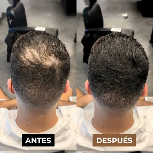 Alivar - Fibra capilar