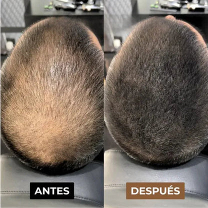 Alivar - Fibra capilar